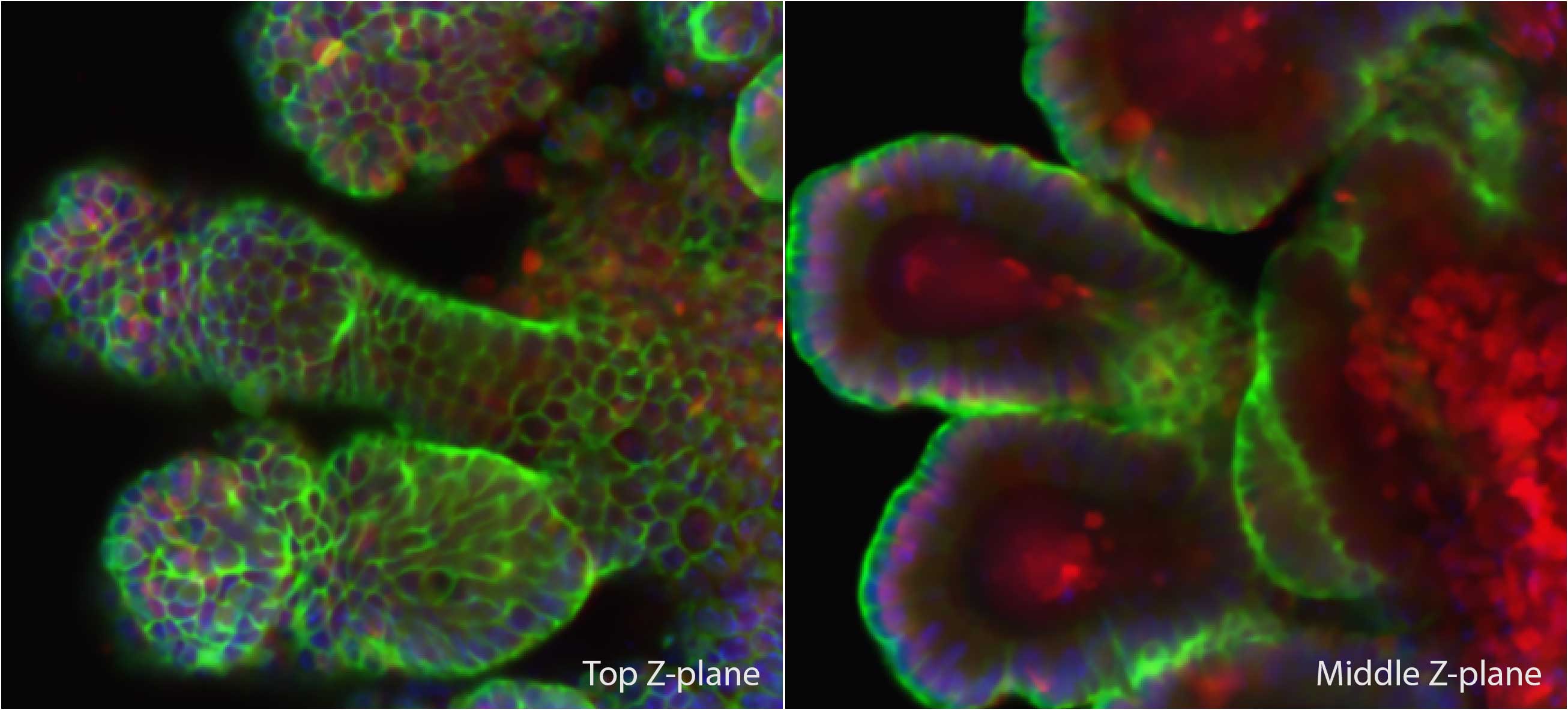 organoid imaging using confocal mode on Lana